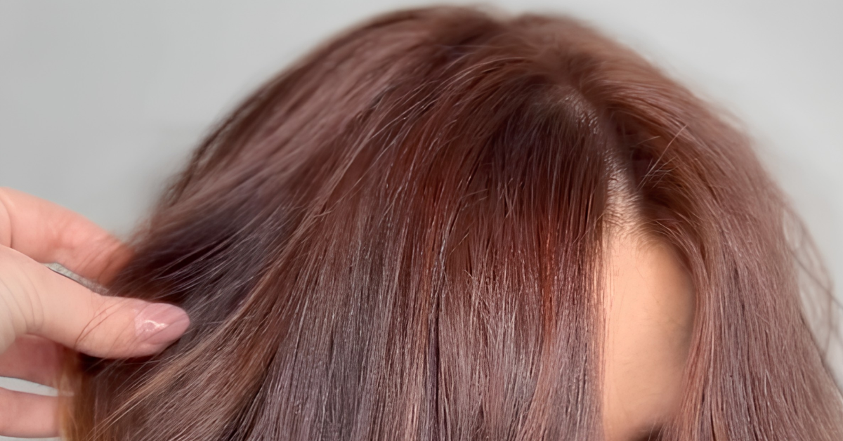 Read more about the article Hair Toppers 101: Everything You Need to Know Before Wearing a Topper